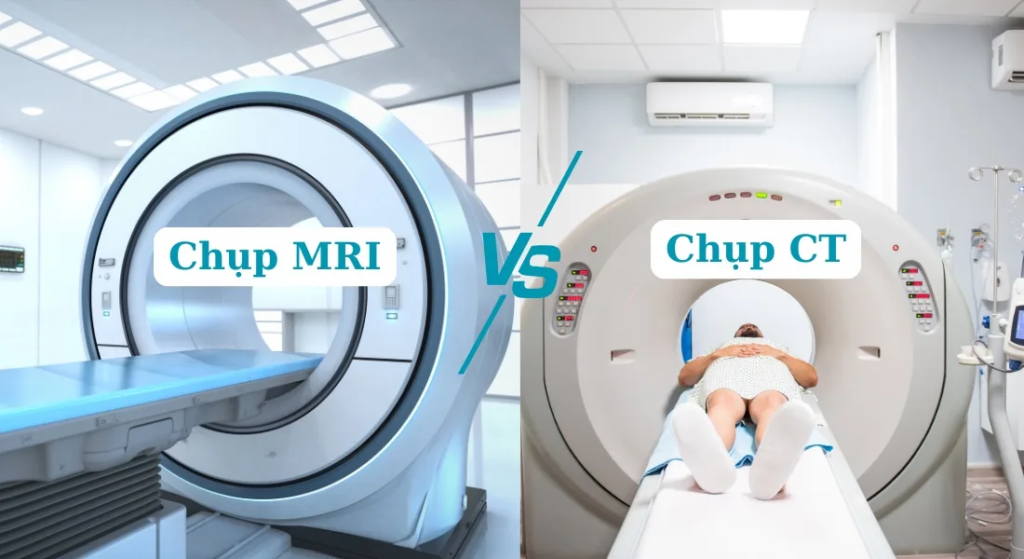 So sánh chụp CT và MRI